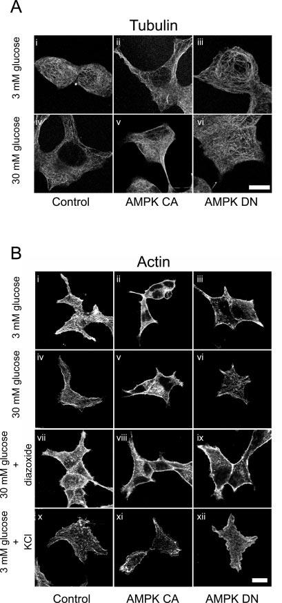 52048 Role of AMPK in Insulin-containing Vesicle Movement FIG. 6. Effect of overexpression of AMPK CA on tubulin and F-actin structure.