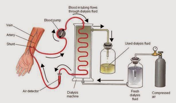 Dialysis is a method of removing one or more components from a solution using the process of diffusion.