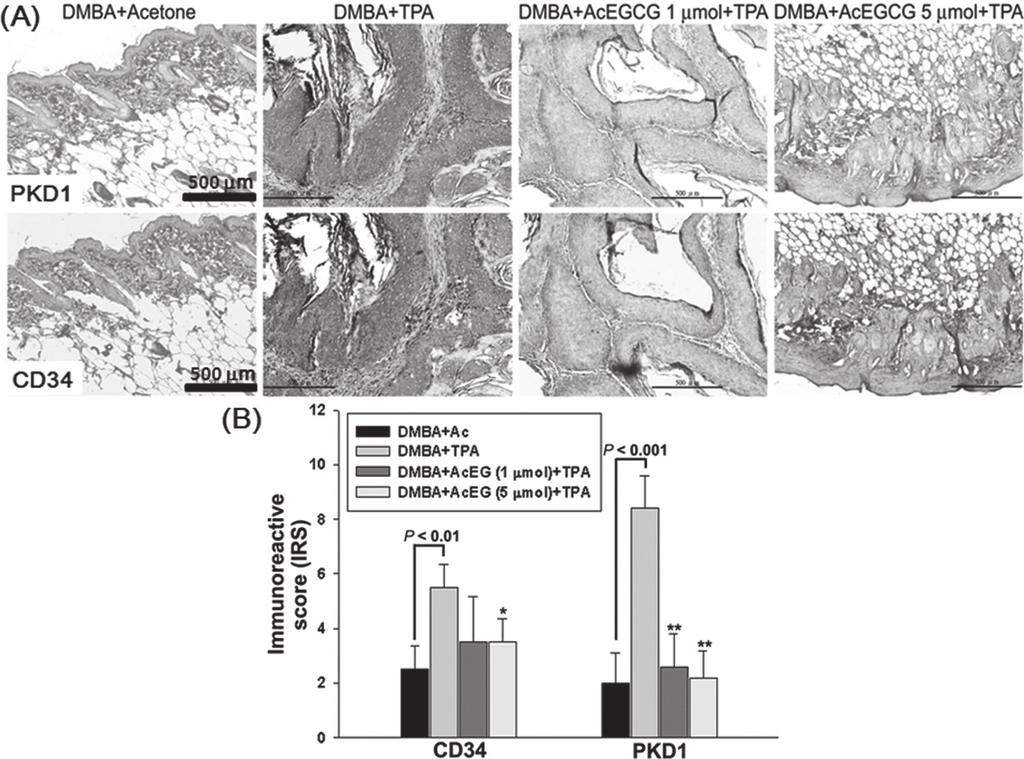 AcEGCG prevents skin carcinogenesis in mice Fig. 3. Inhibitory effect of AcEGCG on DMBA/TPA-induced activation of PKD1 in CD34 + skin stem cells and CSCs.