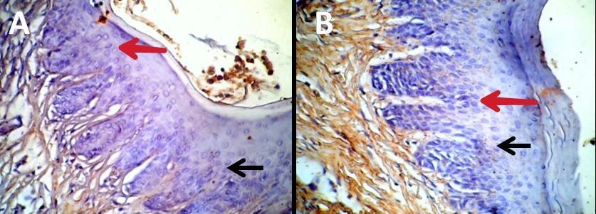 Iimmunohistochemistry of NOD-2 expression in gingival epithelium of each group (magnification 400x). Black arrow (cell expressed TLR-2). Red arrow (cell unexpressed NOD-2).