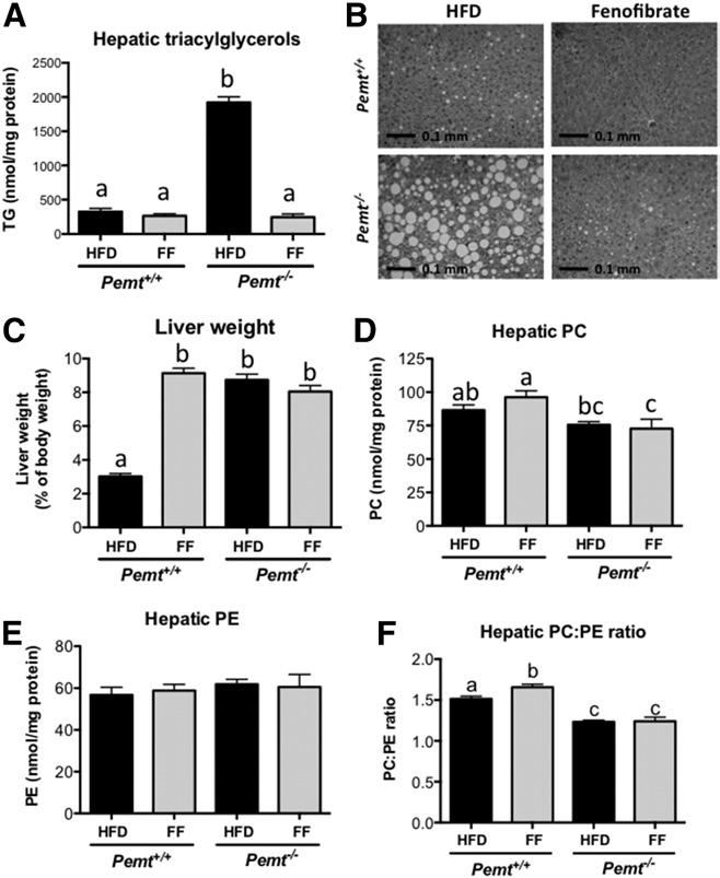Fig. 4. Fenofibrate improved hepatic steatosis in Pemt / mice. A: Hepatic TG was measured in Pemt +/+ and Pemt / mice after 6 weeks of feeding the HFD or HFD + fenofibrate.