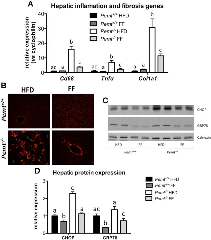 Fig. 5. Fenofibrate reduced hepatic inflammation, fibrosis, and ER stress.