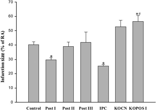 Sphingosine kinase-1 in ischaemia/reperfusion and postconditioning 137 As expected, IPC reduced infarction size and improved cardiac function (Figure 2A C, P, 0.05 vs. the control group).