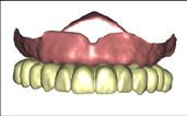 4 2. Tooth anatomy Select the correct tooth anatomy depending on the patient s morphology: Rectangular Square Triangular Ovoid 3.