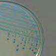 code product name application/description gm/lit unit unit price new/old ` 36198 Candida BCG Agar, Base For use with added Neomycin for isolation 66.02 100 gms 888.