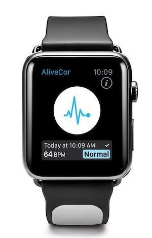 Kardia Mobile - ECG band for Apple Watch Apple Watch starp to take Electrocardiogram