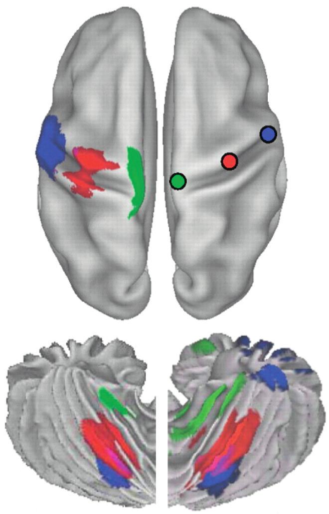 (A) (D) Le (B) -18 Axial -24 Right (C) fcmri Key: Task Foot Hand Tongue 18 Figure 4. Somatomotor topography in the cerebellar cortex.