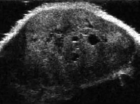 Contrast-enhanced ultrasound of mouse melanoma vasculature