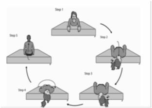 AC BPPV Treatment Head down maneuver WHAT IF EXERCISES FAIL? In step 2', debris falls to apex of AC.