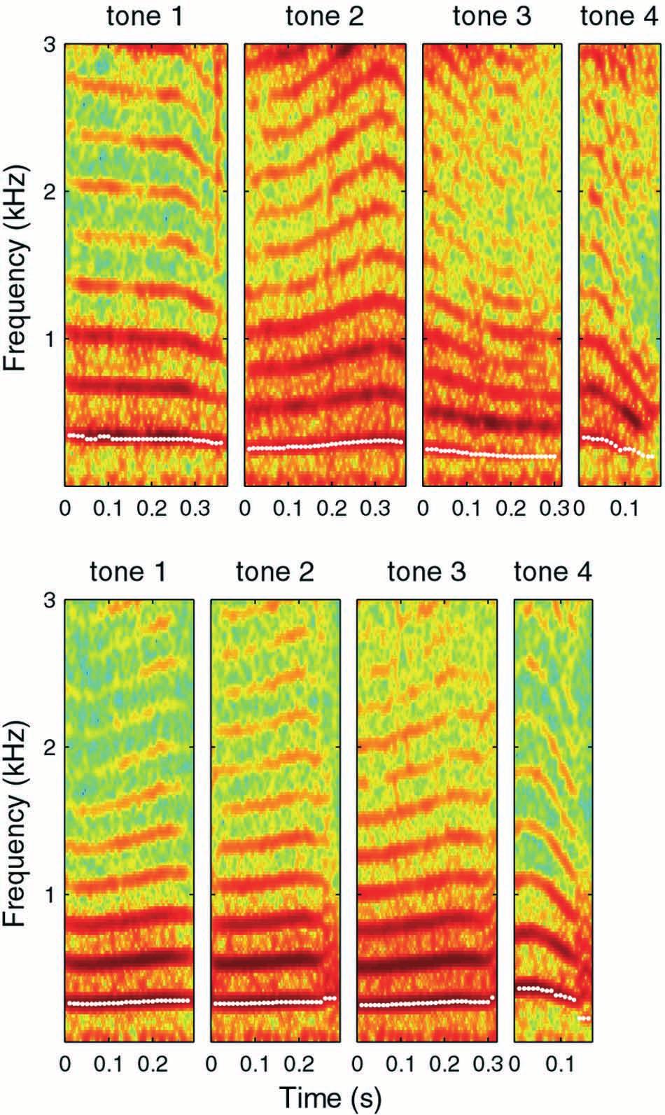 Acta Otolaryngol 124 Tone production by CI children 365 Fig. 1. Spectrograms of speech recordings from a normalhearing child (N7; upper panels) and a child with a CI (S3; lower panels).