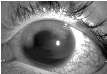 antibiotic Patch eye Prompt