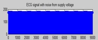 (6) indicates power line noise.
