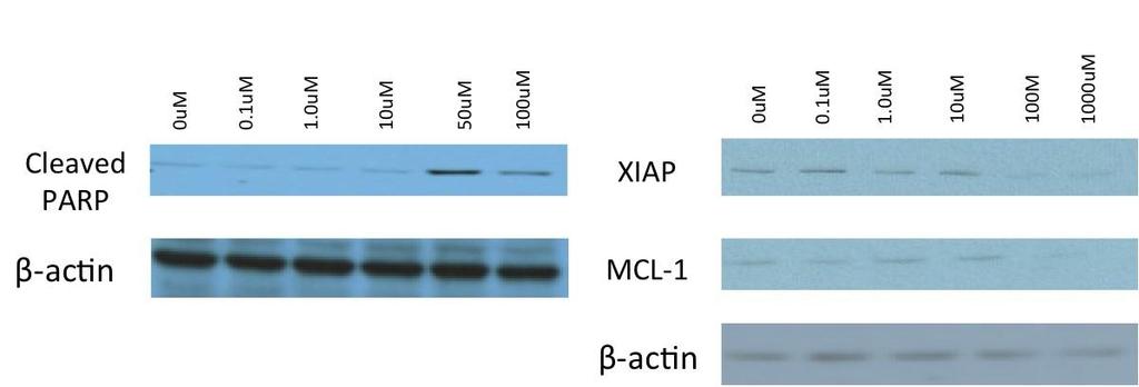 Kinase phosphorylation state was assessed using western blot analysis. Membrane was incubated with antibodies to perk, ERK, pakt, and AKT.