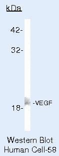 Western blot of Vascular Endothelial Growth Factor using Vascular Endothelial Growth Factor Polyclonal Antibody (Product # PA5-16754) on VEGF Cells.