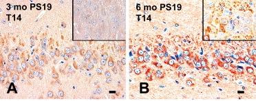 P301S mutant tau transgenic mice P301S mutation In humans