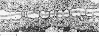 Intercellular Junctions in Plants Plasmodesmata are channels that perforate plant cell walls. The cell s of neighboring cells are continuous through these pores in the cell walls.