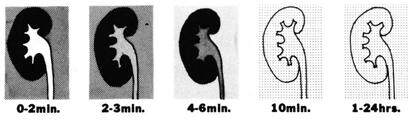 In contrast, the contralateral nonstenotic kidney in R VH shows minimal functional changes which are not overall significantly changed after blockade of the renin-angiotensin system.