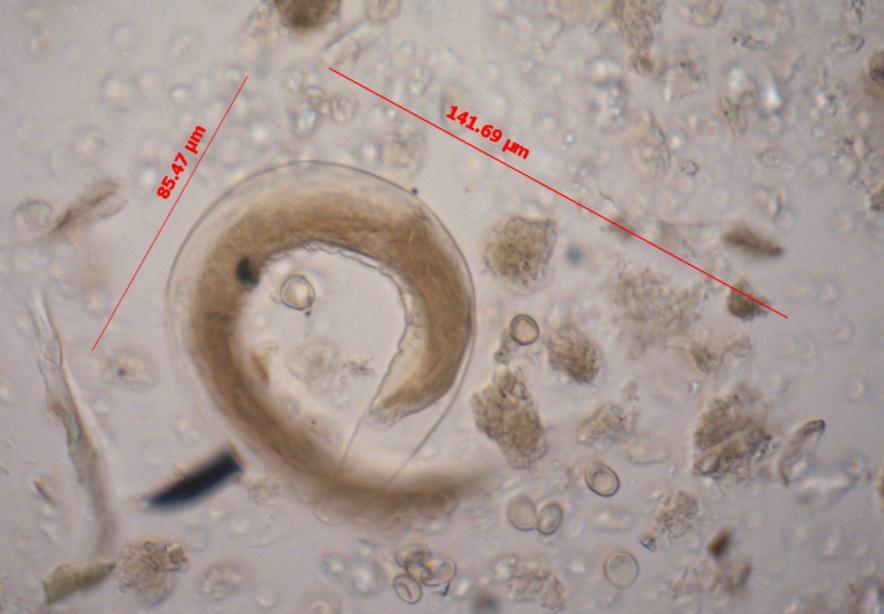 Figure 5. Rhabditiform larvae from Pueblo Bonito.