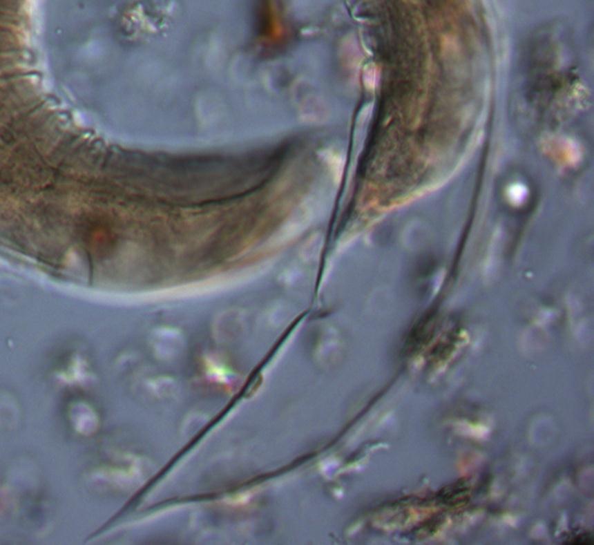 (bottom) are clearly visible in this rhabditiform larva from