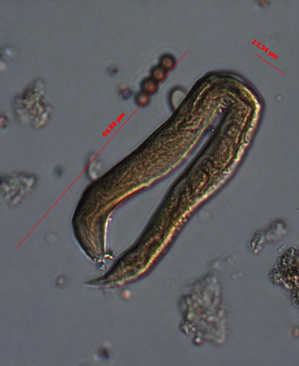 Figure 7. Filariform larva from Pueblo Bonito. This larva resembles the infective stage (L3) of A.