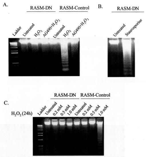 34548 Role of Jak2 in Oxidative Stress-induced Apoptosis FIG. 1.Hydrogen peroxide-induced Jak2 activity is suppressed in RASM-DN cells. RASM-control and RASM-DN cells were treated with 0.2, 0.