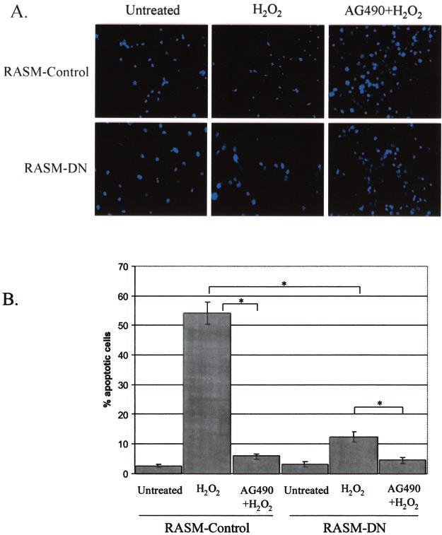 Role of Jak2 in Oxidative Stress-induced Apoptosis 34549 FIG. 3. Quantification of apoptosis in RASM-control and RASM-DN cells treated with hydrogen peroxide.