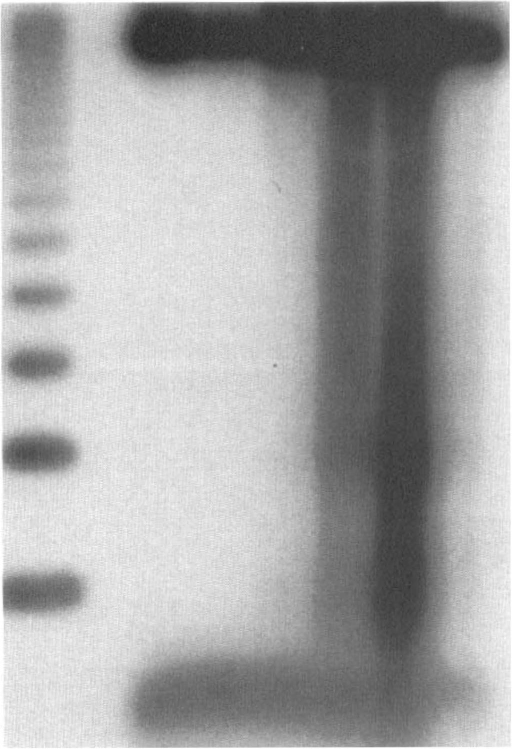 DNA was isolated from ischemic striatal tissue after various times after reperlusion, end-labeled with [32P]ddATP, electrophoresed on a 2% agarose gel, and autoradiographed.