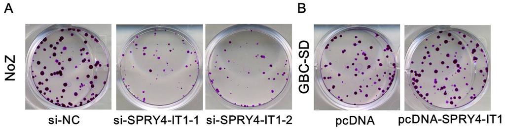 Figure 2. A. The qrt-pcr assay revealed that SPRY4-IT1 was efficiently downexpression by transfected with sirna in NoZ cells; B.