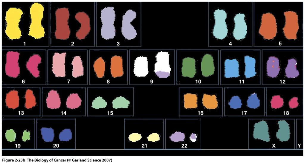 16 shows differences in karyotypes between healthy and cancerous cells. kary/o: nucleus -type: type Figure 1.11: Left: Diploid karyotype of a normal human cell.