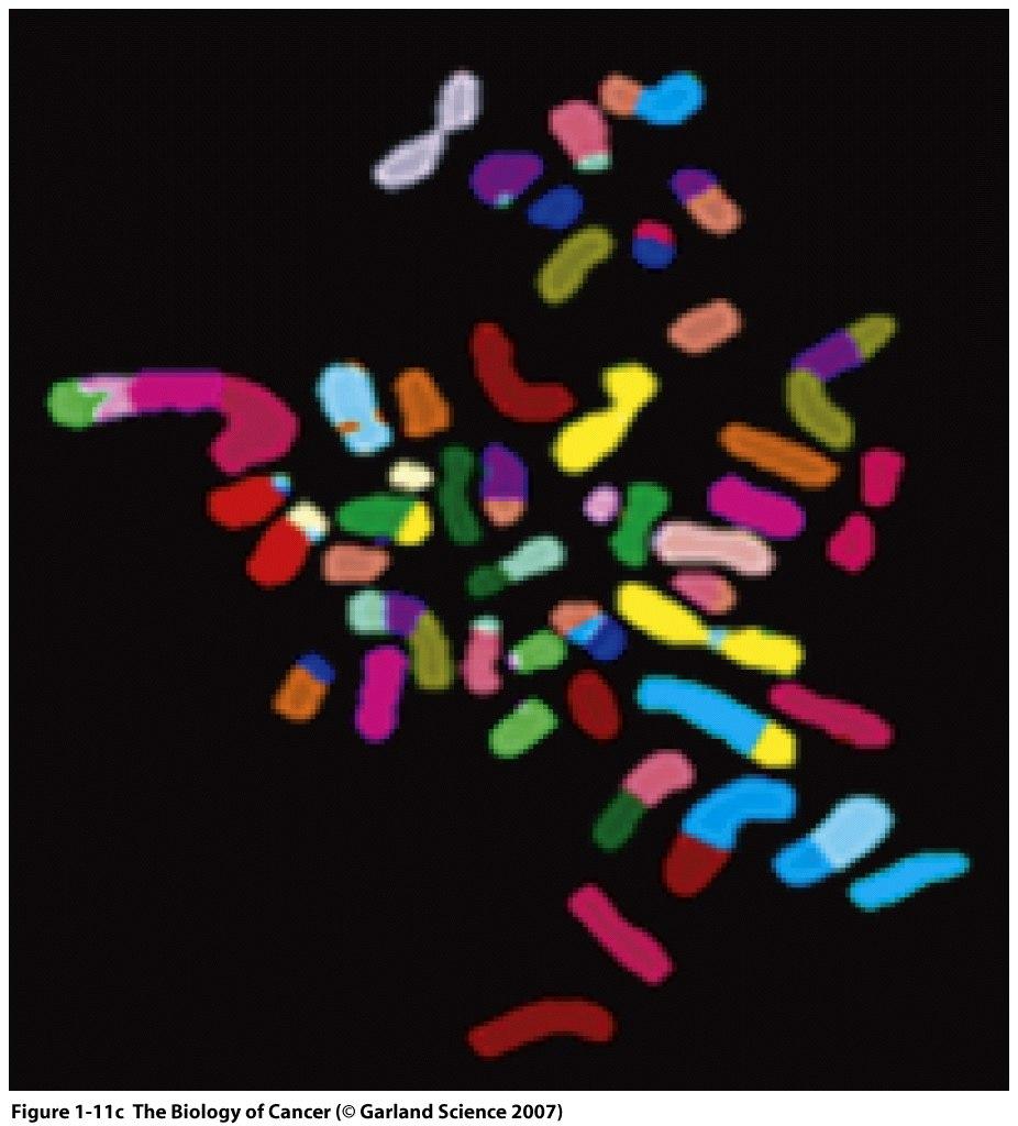 Right: aneuploid karyotype of a breast cancer cell. Note numerous translocations indicated by the varied colors in each chromosome.