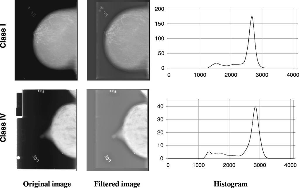 1067 Zhou et al.: Computerized image analysis 1067 FIG. 9.