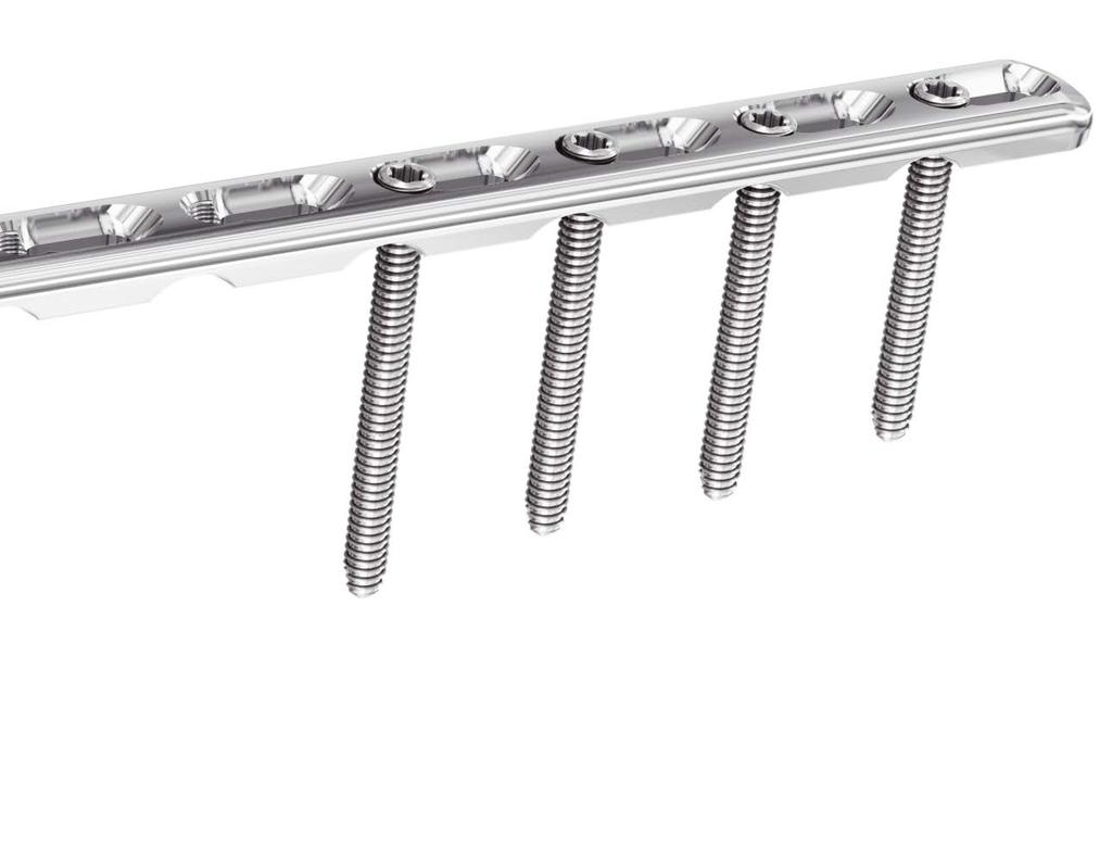 Elongated Combi holes accept 3.5 mm locking screws, 3.5 mm cortex screws and 4.
