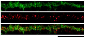 (c) Representtive imges from four experiments of western lotting of totl nd iotinylted surfce proteins from cultured rt hippocmpl neurons expressing PTPN11 or.