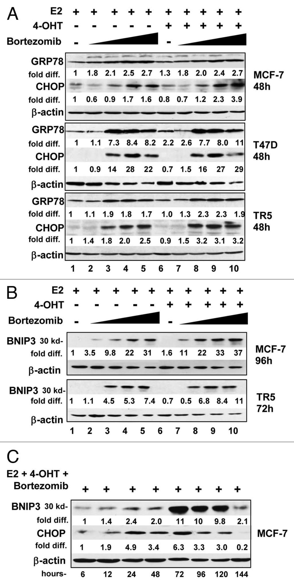 Figure 7. Bortezomib induced ER stress in ER + breast cancer cells and BNIP3 expression.