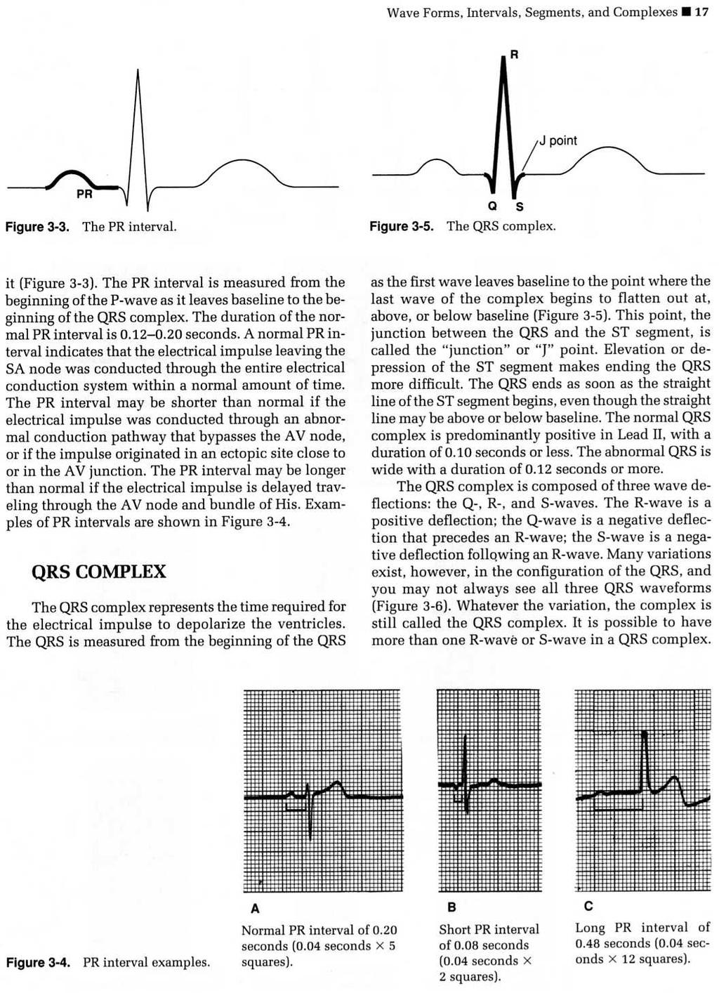 Parts of the ECG Waves Baseline Segments Intervals Waves P wave Waves Q wave, R wave, S wave Represents atrial depolarization Electrical stimulus is sent through the heart to the atria Atria
