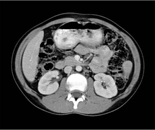 abdominal cross section is