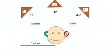 Spatial Speech Perception in Noise Conditions tested: Monaural Direct (MD): signal to good ear/noise to bad ear(+/- 45) Monaural