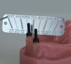 Select the final LOCATOR male replacement retention liner based upon the determined angle measurement of each implant.