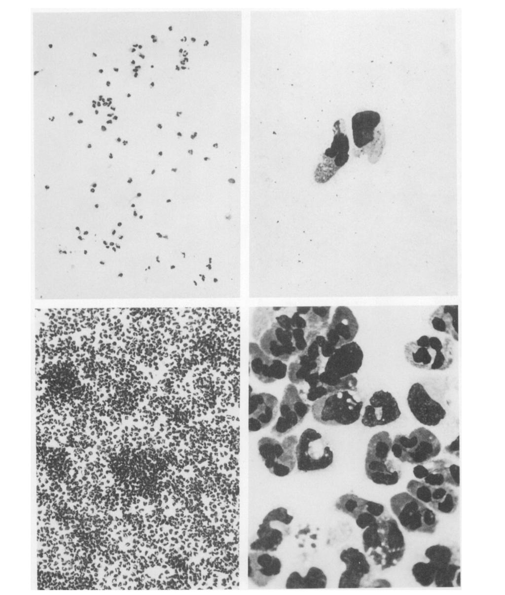 Higher power of a portion of the response shown in Figure 5 in a prekallikrein-deficient patient. The responding leukocytes are neutrophils and monocytes as shown. Leishman's stain (X1,000). FIG.