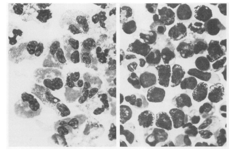 The leukocytic sequence after antigen at this stage consists predominantly of large mononuclears (transformed lymphocytes and activated monocytes). Leishman's stain (X 1.000). Fie 10 {upper, right).