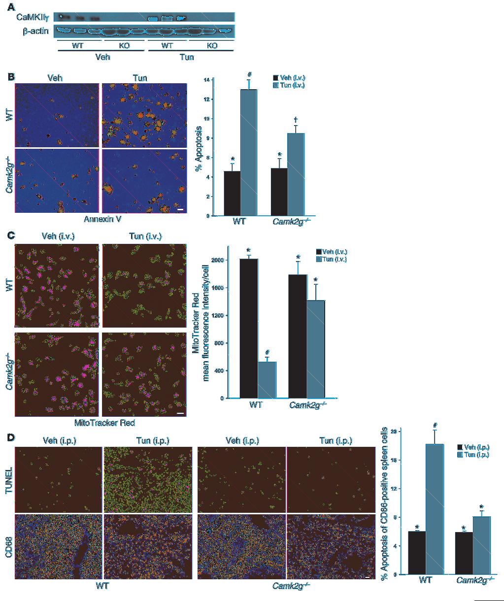 Figure 8 Importance of CaMKIIγ in macrophage apoptosis and Δψ m in ER-stressed mice. (A C) WT and Camk2g / mice were injected i.v. with tunicamycin or vehicle control.