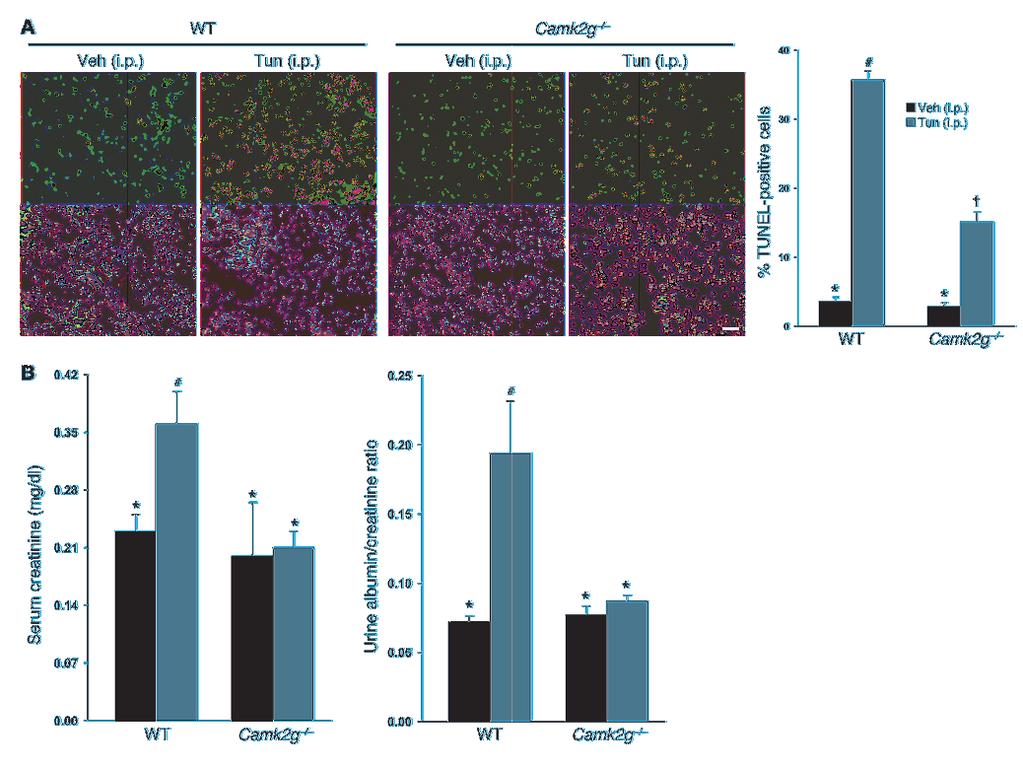 Figure 9 Importance of CaMKIIγ in renal tubular epithelial cell apoptosis and renal function in ER-stressed mice. WT and Camk2g / mice were injected i.p. with 1 mg/kg tunicamycin or vehicle control.