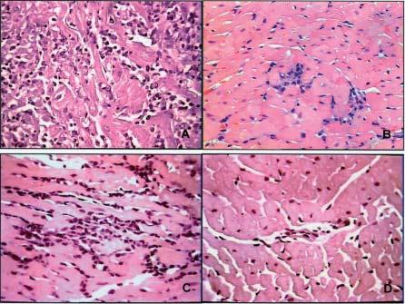 Mem Inst Oswaldo Cruz, Rio de Janeiro, Vol. 99(4), June 2004 409 Histopathological lesions Y strain (Biodeme Type I): heart - C.
