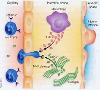 PMN Emigration PMN leave blood in response to chemokines IL-8 acpgp ( acetylated Pro- Gly-Pro = derived by proteolysis of collagen) Chemokine receptors - CXCR1, CXCR2 Diapedesis (exit from blood)