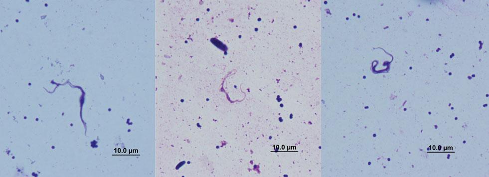 J. M. Austen and others 868 Fig. 1. Light photomicrographs of trypanosomes in Modified Wright s stain detected in the faeces of the tick.