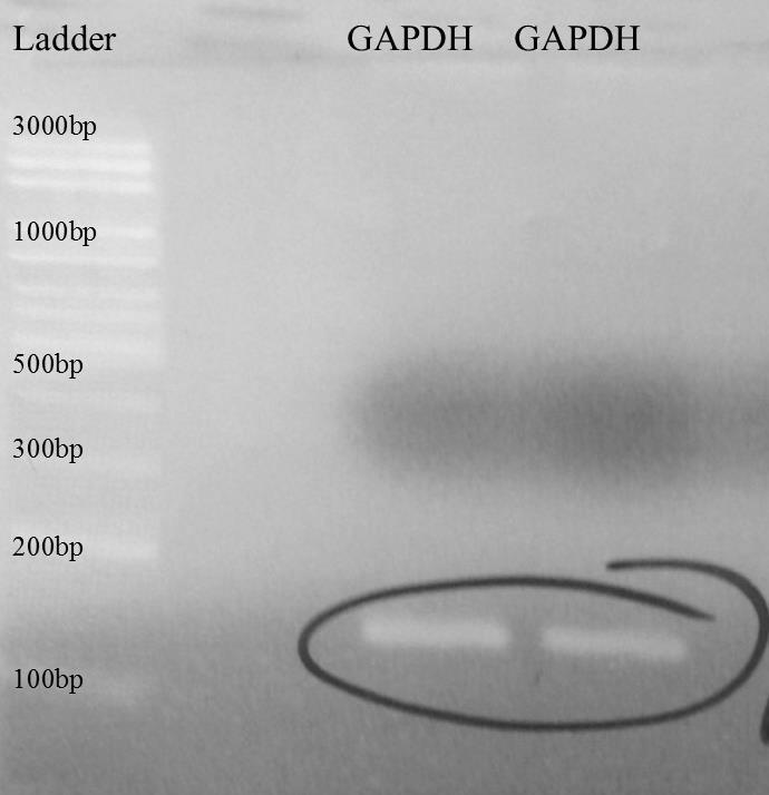 Greenwald 30 Figure 17: PCR products of human liver cdna using the mouse primers for the housekeeping gene GAPDH.