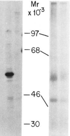 Alternative splicing Greenwald 8 Alternative splicing is prevalent in the immune system, and has been noted among cell surface adhesion molecules 23,24.