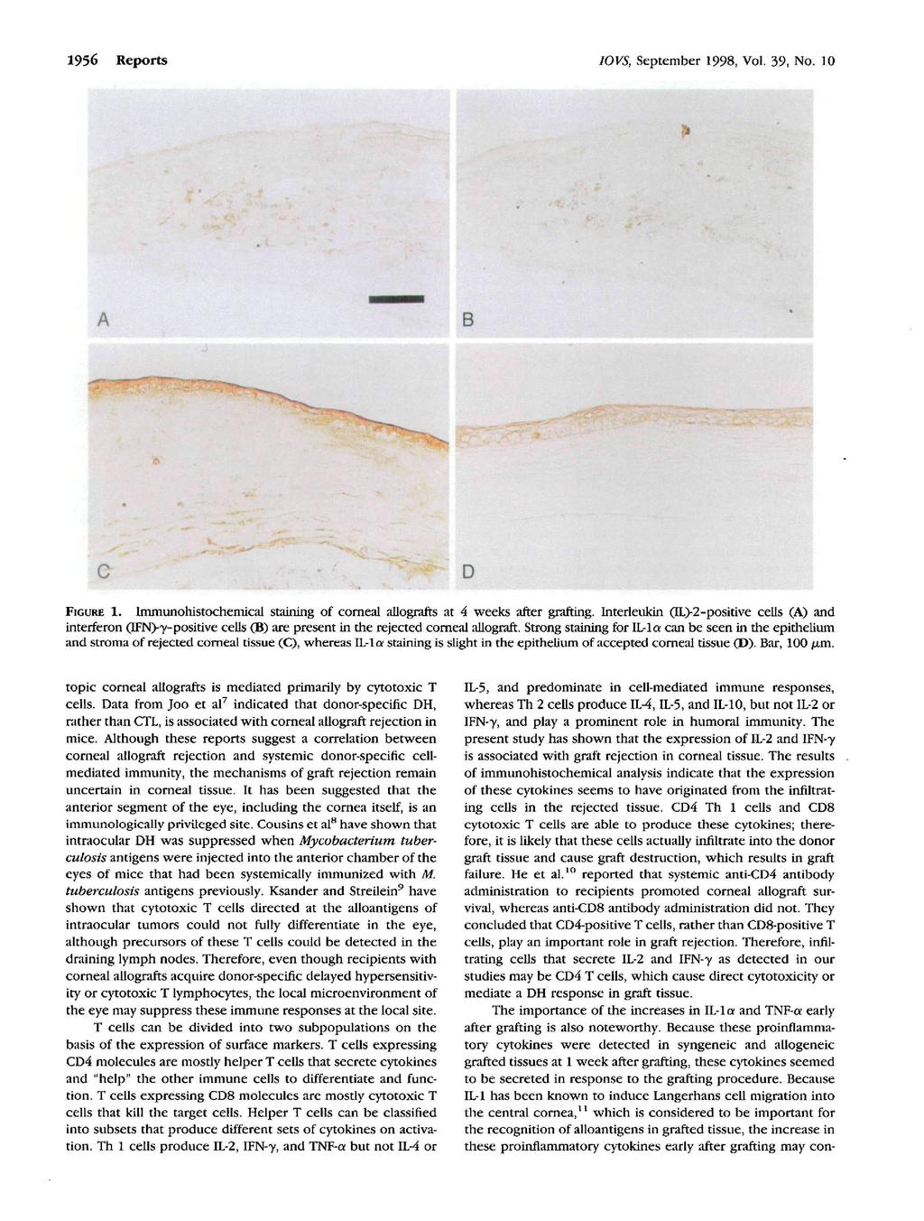 1956 Reports IOVS, September 1998, Vol. 39, No. 10 B C D 1. lmmunohistochemical staining of corneal allografts at 4 weeks after grafting.
