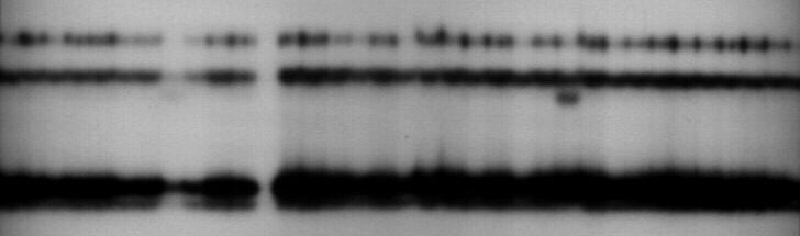 The Myh exon 2 PCR-SSCP Wild-type bands are bands that are similar to the most of the other bands; in this case it meant patients with the same fragment for the Myh exon 2.