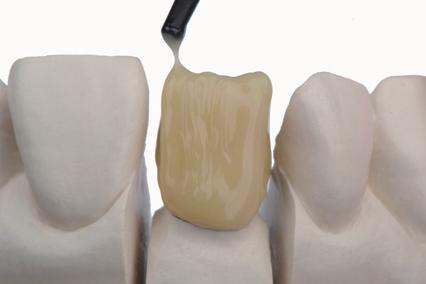 anatomical body shape of the natural tooth. Fix the buildup for 5-20 seconds with Sublite V.